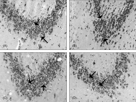 Photomicrographs of the CA3 hippocampal region. (A) DMSO + ss; (B) DMSO ... 