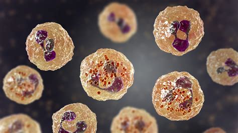 Six Dead As Meningococcal Disease Breakout Hits Floridas Gay