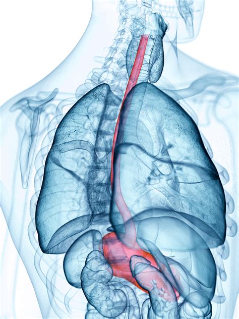 Eosinophilic Esophagitis | MedlinePlus