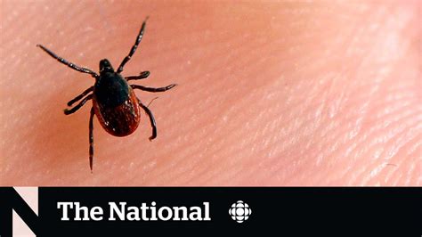 How To Protect Yourself From Lyme Disease Even If You Get Bitten Youtube