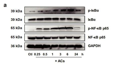 Phospho Nf Kb P65 Ser536 Antibody Affinity Biosciences