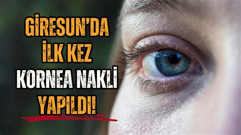 Giresunda ilk kez kornea nakli yapıldı