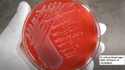 Atlas Of Bacteria Introduction And List Of Bacteria And Related Features