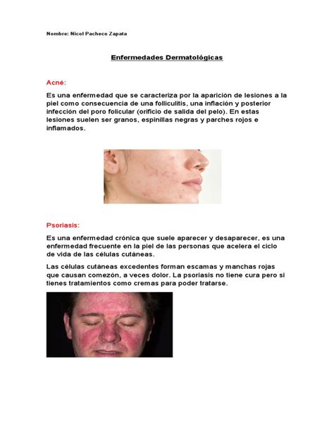 Enfermedades Dermatologicas | PDF