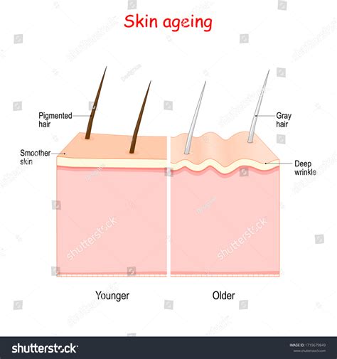 Aging Process Smoother Younger Skin Pigmented Stock Vector (Royalty Free) 1719679849 | Shutterstock