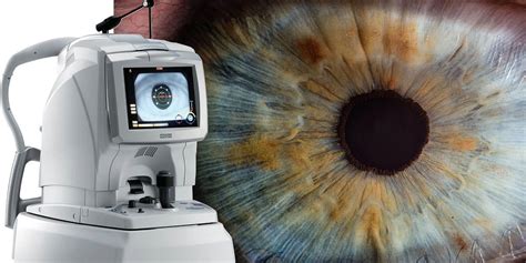 Optical Coherence Tomography Oct Scan Canon Street Optometrists