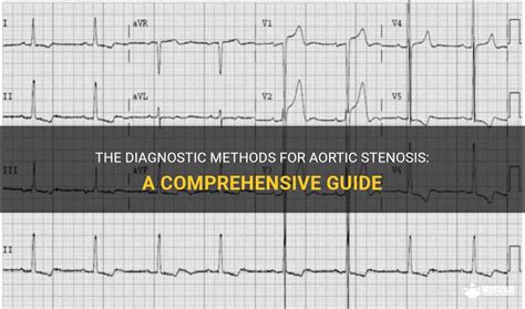 The Diagnostic Methods For Aortic Stenosis: A Comprehensive Guide | MedShun