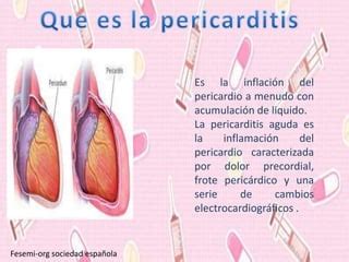 Pericarditis anatomía fisiopatología síntomas tratamiento