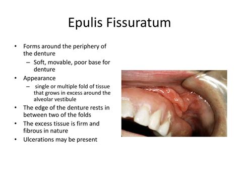 Ppt Soft Tissue Abnormalities Powerpoint Presentation Free Download