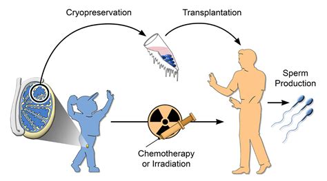 Frozen Testicular Tissue Still Viable After 20 Years Penn Today