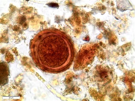 Parasitología Controllab