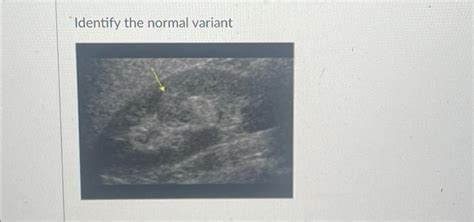 Identify the normal variant | Chegg.com 