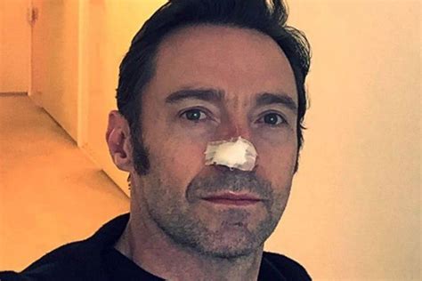 Lacteur Australien Hugh Jackman à Nouveau Traité Pour Un Cancer De La