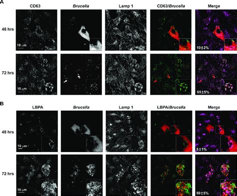 Colocalization Of LAMP 1 With Brucella And LBPA Or CD63 In Infected