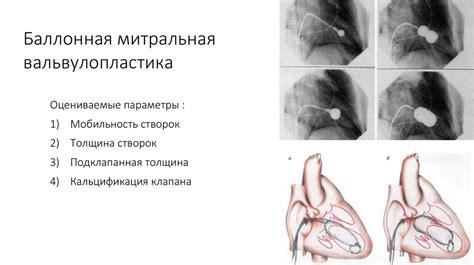 Основы кардиохирургии - презентация онлайн
