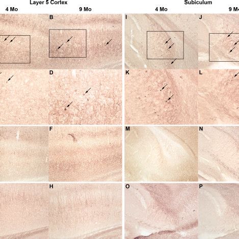 Xfad Mice Exhibit Neuron Loss In Layer Cortex And Subiculum