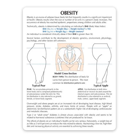 Snapklik.com : Obesity Model, Replica Of The Hip Area Depicting Effects