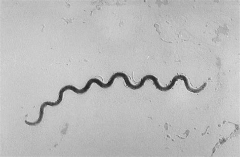 Introduction To Spirochetes Microbiology Medbullets Step 1