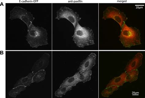 Mapping The Dynamics Of Force Transduction At Cellcell Junctions Of