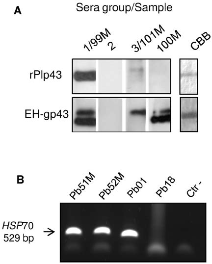 A Representative Immunoblot Reactions Of Pcm Patients Sera 11000