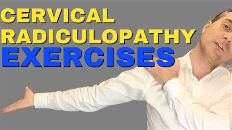 Cervical Radiculopathy Exercises Video