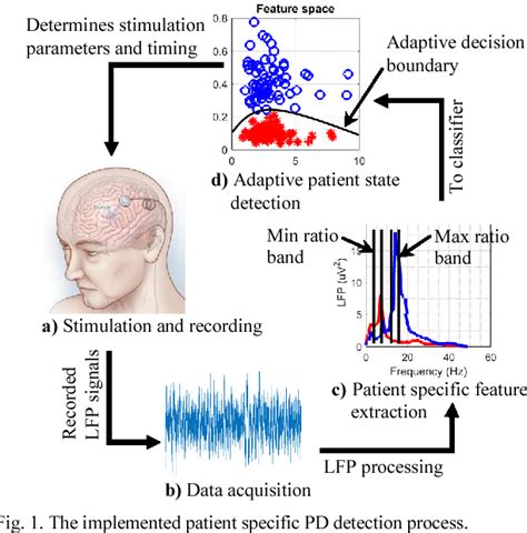 Figure From Patient Specific Parkinson S Disease Detection For