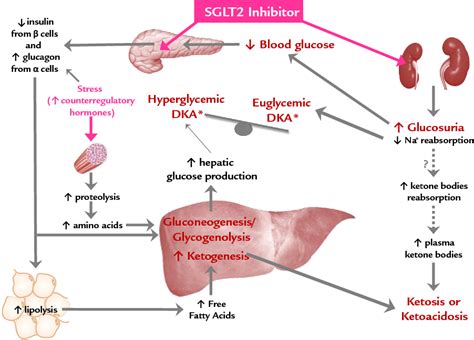 Figure 1 From Sglt2 Inhibitor Associated Diabetic Ketoacidosis