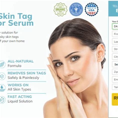 Stream Remedy Skin Tag Remover Official Website By Madeline Payne