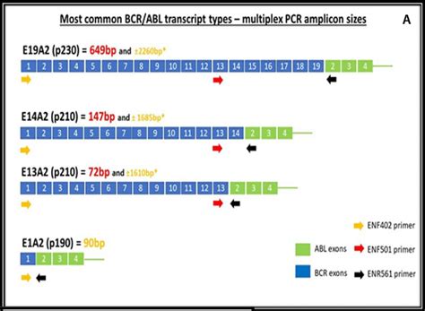 Multiplex BCR/ABL PCR assay design | Download Scientific Diagram