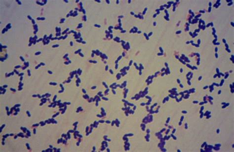 Streptococcus Pneumoniae Under Microscope