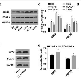 MiR 185 3p Expression Reduces While SOX2 CCAT1 And FOXP3 Expressions