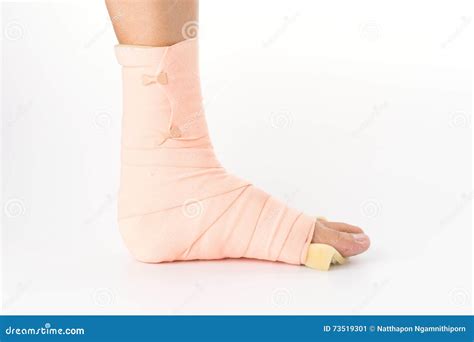 Leg In A Bandage Cast Stock Image Image Of Equipment 73519301