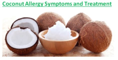 Coconut Allergy Symptoms and Treatment - Fruits Facts