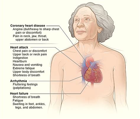 What is Coronary Heart Disease - Causes, Signs, Symptoms & Treatment