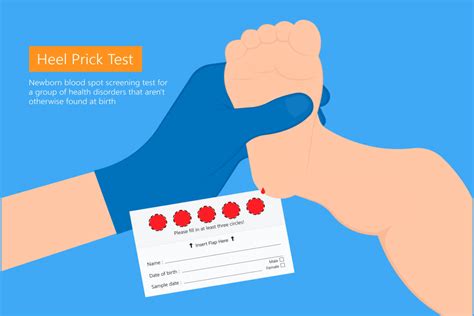 Newborn Heel Stick Test For Babies Significance And Complications