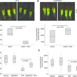 FAK Regulates TPA Induced Epidermal Hyperplasia A Western Blot