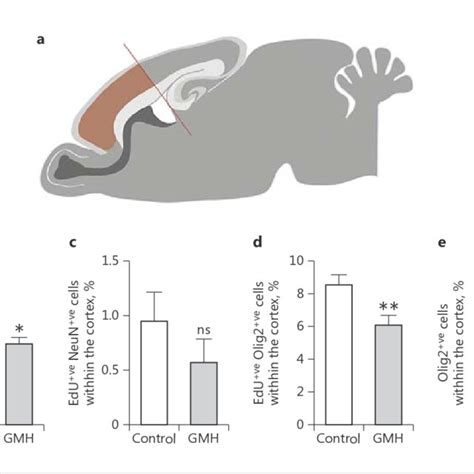 Germinal Matrix Haemorrhage Gmh At P0 Impacts Early Cortical