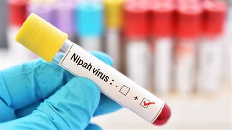 Nipah Virus Whats Behind Repeated Spreading In Kerala Govt Orders