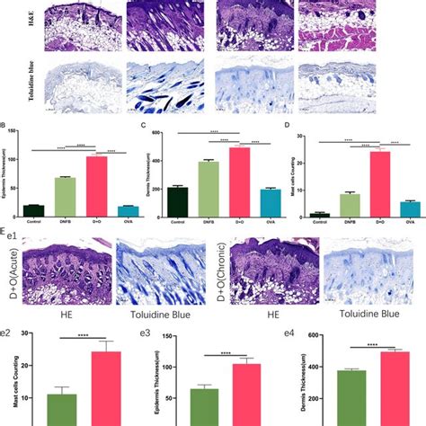 Dnfb Ova Induced Typical Ad Like Phenotypic And Histologic Changes In