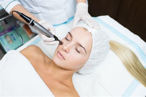 Microneedling Magik Esthetik