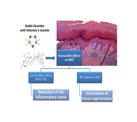 Molecules Free Full Text Anti Inflammatory And Tissue Regenerative