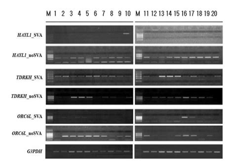 Reverse Transcription Polymerase Chain Reaction Analysis Of Transcript