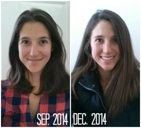 Biotin Hair Growth: Biotin Hair Growth Results Blogging