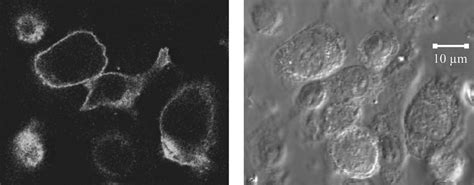 Localization Of Heterologously Expressed Vsv Tagged Rhodopsin In The