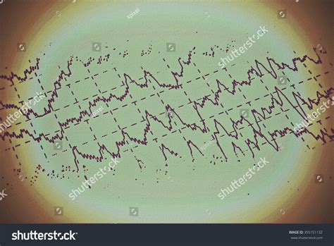 Brain Wave On Electroencephalogram Eeg Epilepsy Stock Illustration