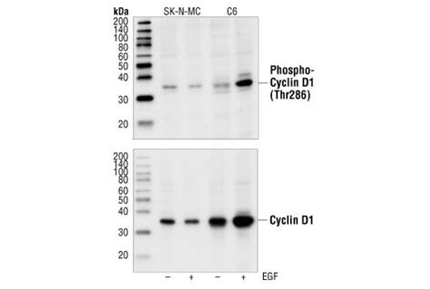 Phospho Cyclin D1 Thr286 Antibody Cell Signaling Technology