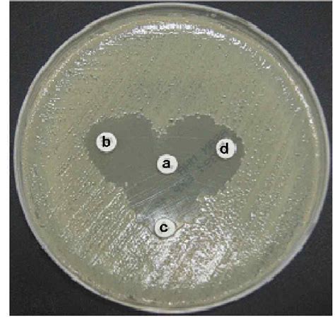 Photograph Of Double Disk Synergy Test With E Coli Producing Esbls A