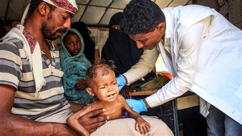 Famine conditions in war-torn Yemen rising sharply: UN - Al-Monitor ...