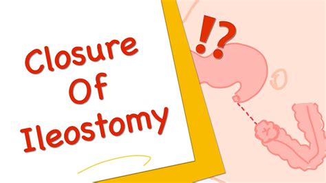 Ileostomy Closure Takedown In A 1 Month Old Girl By Dr Tamer Ashraf Wafa Dr Amr El Saeid