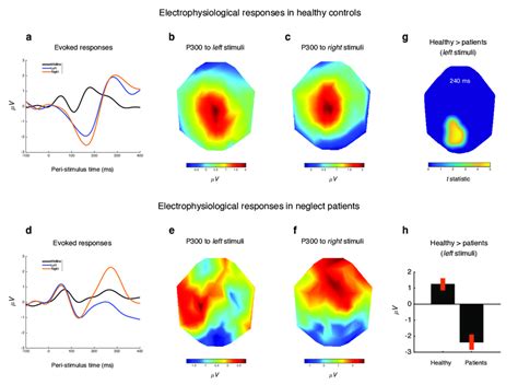 Evoked Cortical Responses In Healthy Participants And Neglect Patients Download Scientific